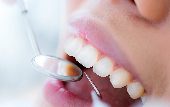 Ağız Ve Diş Sağlığı İçin En Doğru Klinik Tercihi